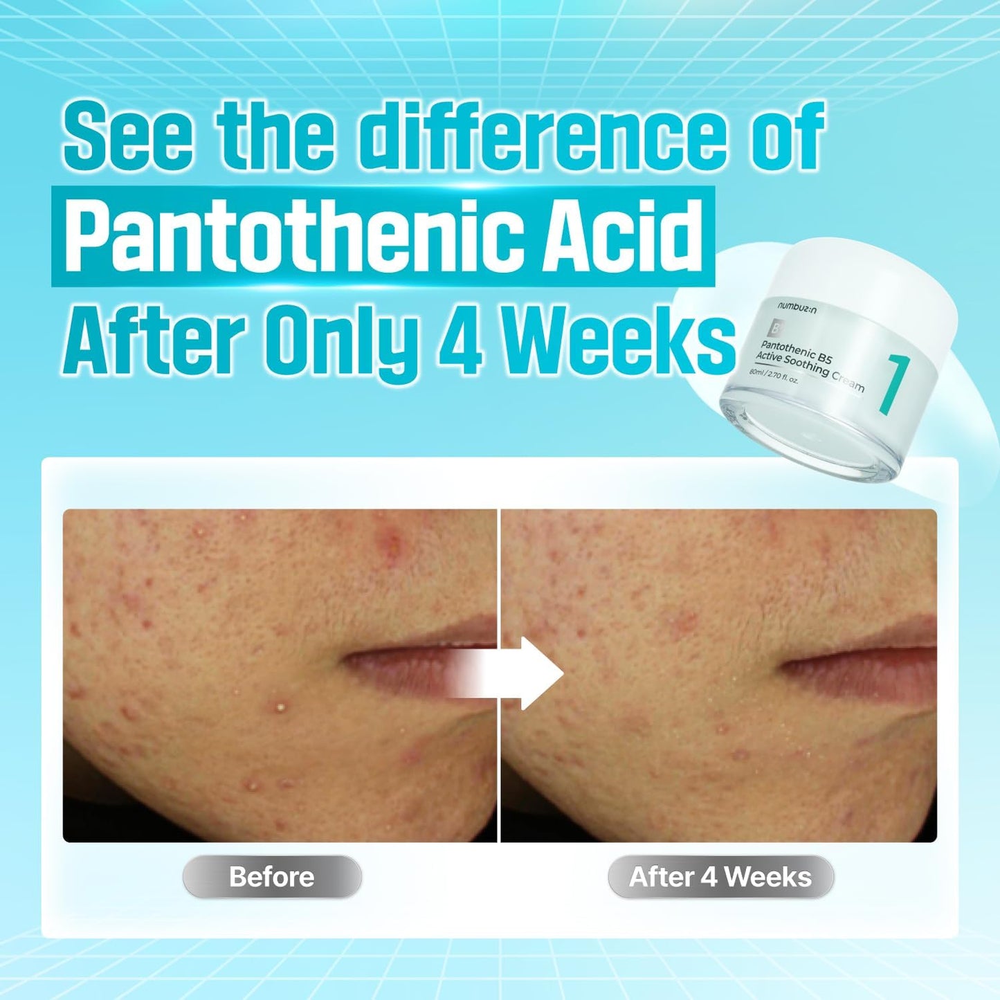 Numbuzin No.1 Pantothenic B5 Active Soothing Cream (2.70 fl oz / 80ml)